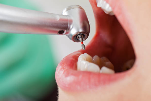 Best Emergency Dentist Near Me  in Grizzly Flats, CA
